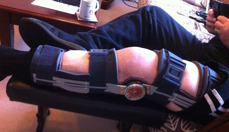 Leg brace